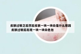 皮膚過敏之后然后皮膚一塊一塊白是什么原因 皮膚過敏后出現(xiàn)一塊一塊白色包