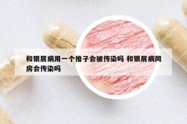 和銀屑病用一個(gè)推子會(huì)被傳染嗎 和銀屑病同房會(huì)傳染嗎