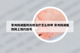 常州陽湖醫(yī)院白斑治療怎么樣啊 常州陽湖醫(yī)院網(wǎng)上預約掛號