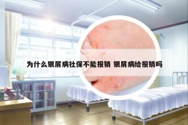 為什么銀屑病社保不能報銷 銀屑病給報銷嗎