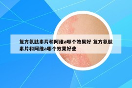 復(fù)方氨肽素片和阿維a哪個(gè)效果好 復(fù)方氨肽素片和阿維a哪個(gè)效果好些
