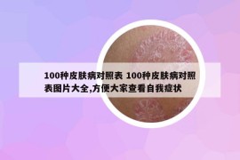 100種皮膚病對照表 100種皮膚病對照表圖片大全,方便大家查看自我癥狀
