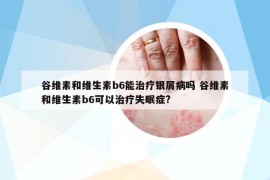 谷維素和維生素b6能治療銀屑病嗎 谷維素和維生素b6可以治療失眠癥?