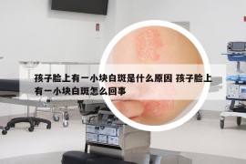 孩子臉上有一小塊白斑是什么原因 孩子臉上有一小塊白斑怎么回事