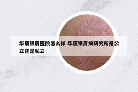華廈銀屑醫(yī)院怎么樣 華廈銀屑病研究所是公立還是私立