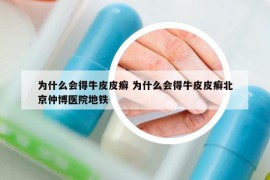 為什么會(huì)得牛皮皮癬 為什么會(huì)得牛皮皮癬北京仲博醫(yī)院地鐵