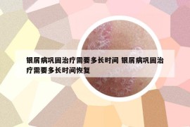 銀屑病鞏固治療需要多長(zhǎng)時(shí)間 銀屑病鞏固治療需要多長(zhǎng)時(shí)間恢復(fù)