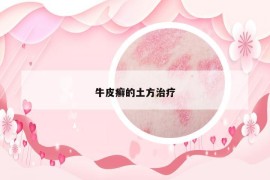 牛皮癬的土方治療