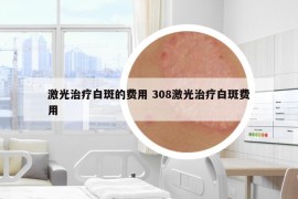 激光治療白斑的費用 308激光治療白斑費用