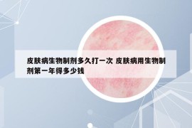 皮膚病生物制劑多久打一次 皮膚病用生物制劑第一年得多少錢