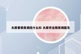 太原看銀屑病掛什么科 太原市治銀屑病醫(yī)生