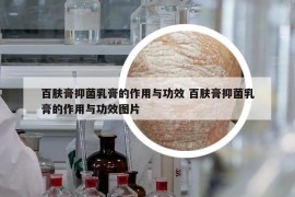 百膚膏抑菌乳膏的作用與功效 百膚膏抑菌乳膏的作用與功效圖片