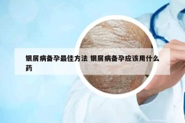 銀屑病備孕最佳方法 銀屑病備孕應(yīng)該用什么藥