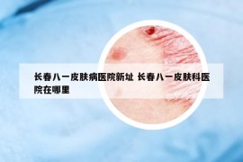 長春八一皮膚病醫(yī)院新址 長春八一皮膚科醫(yī)院在哪里