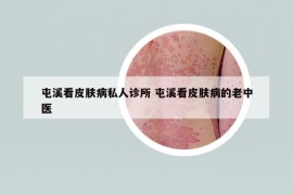 屯溪看皮膚病私人診所 屯溪看皮膚病的老中醫(yī)