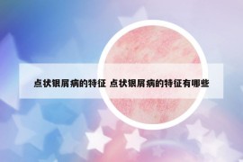 點(diǎn)狀銀屑病的特征 點(diǎn)狀銀屑病的特征有哪些