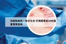 烏司奴單抗一年打幾次 打司庫(kù)奇尤16針后復(fù)發(fā)率高嗎