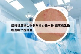 淄博銀屑病生物制劑多少錢一針 銀屑病生物制劑哪個醫(yī)院有