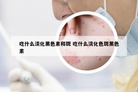 吃什么淡化黑色素和斑 吃什么淡化色斑黑色素