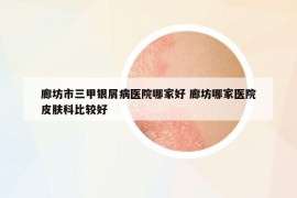 廊坊市三甲銀屑病醫(yī)院哪家好 廊坊哪家醫(yī)院皮膚科比較好