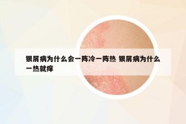 銀屑病為什么會一陣冷一陣熱 銀屑病為什么一熱就癢