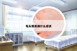 龜頭銀屑病什么癥狀