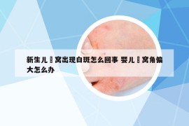 新生兒腘窩出現(xiàn)白斑怎么回事 嬰兒腘窩角偏大怎么辦
