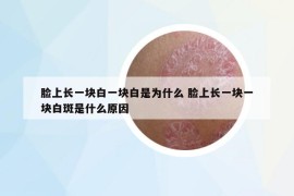 臉上長一塊白一塊白是為什么 臉上長一塊一塊白斑是什么原因