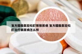 復方醋酸氟輕松酊銀銀屑病 復方醋酸氟輕松酊治療銀屑病怎么樣