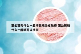 蒲公英和什么一起搭配喝治皮膚癬 蒲公英和什么一起喝可以祛斑