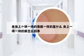 身體上一塊一塊的像癬一樣的是什么 身上一塊一塊的癬怎么回事