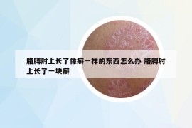 胳膊肘上長了像癬一樣的東西怎么辦 胳膊肘上長了一塊癬