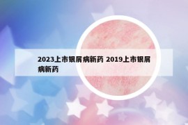 2023上市銀屑病新藥 2019上市銀屑病新藥