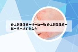 身上到處像癬一樣一塊一塊 身上到處像癬一樣一塊一塊的怎么辦