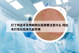 打了阿達木生物制劑以后需要注意什么 阿達木打完以后多久起作用