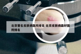 北京著名皮膚病醫(yī)院排名 北京皮膚病最好醫(yī)院排名