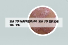 濱州華海白癜風(fēng)醫(yī)院好嗎 濱州華海醫(yī)院能相信嗎 論壇