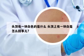 頭頂有一塊白色的是什么 頭頂上有一塊白是怎么回事兒?