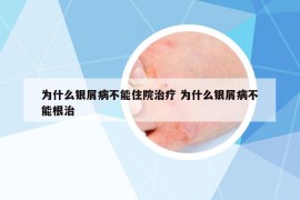 為什么銀屑病不能住院治療 為什么銀屑病不能根治