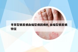 尋常型銀屑病血燥型病因病機 血燥型銀屑病特征