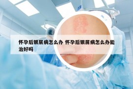 懷孕后銀屑病怎么辦 懷孕后銀屑病怎么辦能治好嗎