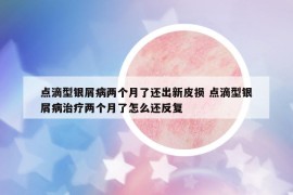 點滴型銀屑病兩個月了還出新皮損 點滴型銀屑病治療兩個月了怎么還反復(fù)
