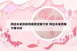 阿達(dá)木單抗和司庫奇尤哪個好 阿達(dá)木單抗哪個牌子好