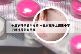 十三歲孩子長牛皮癬 十三歲孩子上課集中不了精神是怎么回事