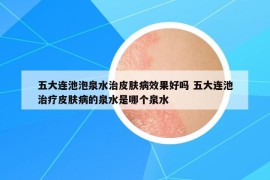 五大連池泡泉水治皮膚病效果好嗎 五大連池治療皮膚病的泉水是哪個(gè)泉水