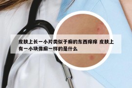 皮膚上長一小片類似于癬的東西癢癢 皮膚上有一小塊像癬一樣的是什么