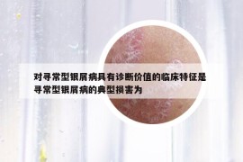 對尋常型銀屑病具有診斷價值的臨床特征是 尋常型銀屑病的典型損害為