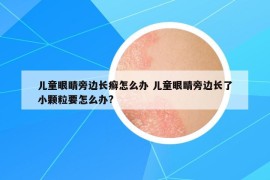 兒童眼睛旁邊長癬怎么辦 兒童眼睛旁邊長了小顆粒要怎么辦?