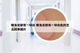 眼角皮膚有一塊白 眼角皮膚有一塊白色的怎么回事圖片