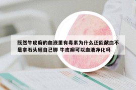 既然牛皮癬的血液里有毒素為什么還能獻(xiàn)血不是拿石頭砸自己腳 牛皮癬可以血液凈化嗎
